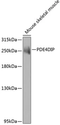 Anti-Myomegalin antibody used in Western Blot (WB). GTX65962