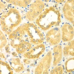 Anti-Myomegalin antibody used in IHC (Paraffin sections) (IHC-P). GTX65962