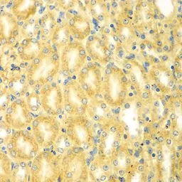 Anti-Myomegalin antibody used in IHC (Paraffin sections) (IHC-P). GTX65962