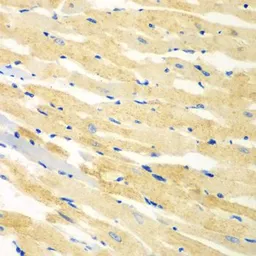 Anti-Myomegalin antibody used in IHC (Paraffin sections) (IHC-P). GTX65962