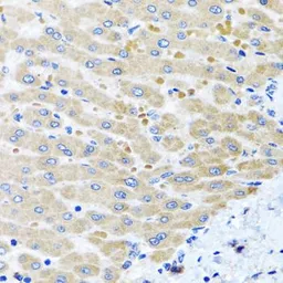 Anti-AspRS antibody used in IHC (Paraffin sections) (IHC-P). GTX65963