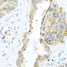 Anti-AspRS antibody used in IHC (Paraffin sections) (IHC-P). GTX65963
