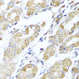 Anti-AspRS antibody used in IHC (Paraffin sections) (IHC-P). GTX65963