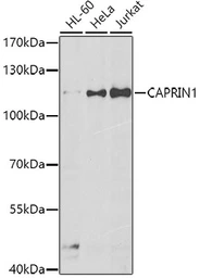 Anti-GPIP137 antibody used in Western Blot (WB). GTX65964