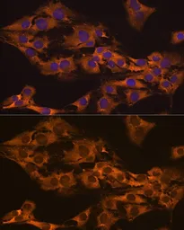 Anti-GPIP137 antibody used in Immunocytochemistry/ Immunofluorescence (ICC/IF). GTX65964