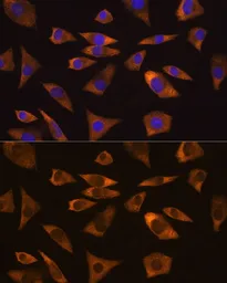 Anti-GPIP137 antibody used in Immunocytochemistry/ Immunofluorescence (ICC/IF). GTX65964