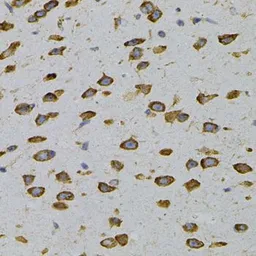 Anti-GPIP137 antibody used in IHC (Paraffin sections) (IHC-P). GTX65964