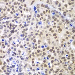 Anti-Lhx4 antibody used in IHC (Paraffin sections) (IHC-P). GTX65966