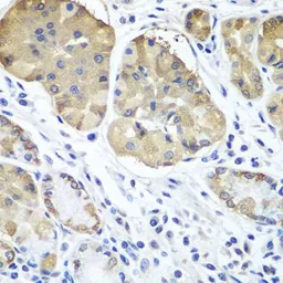 Anti-PLCB2 antibody used in IHC (Paraffin sections) (IHC-P). GTX65967