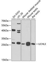 Anti-UCHL3 antibody used in Western Blot (WB). GTX65968