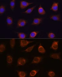 Anti-METTL7A antibody used in Immunocytochemistry/ Immunofluorescence (ICC/IF). GTX65969