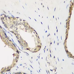 Anti-METTL7A antibody used in IHC (Paraffin sections) (IHC-P). GTX65969