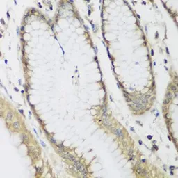 Anti-METTL7A antibody used in IHC (Paraffin sections) (IHC-P). GTX65969