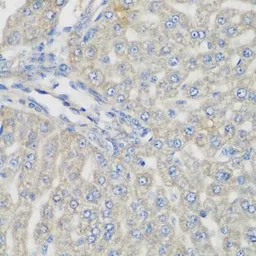 Anti-METTL7A antibody used in IHC (Paraffin sections) (IHC-P). GTX65969