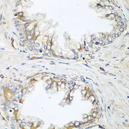 Anti-HPA2 antibody used in IHC (Paraffin sections) (IHC-P). GTX65971