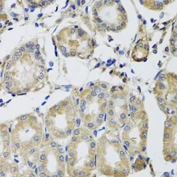 Anti-MRPS22 antibody used in IHC (Paraffin sections) (IHC-P). GTX65972