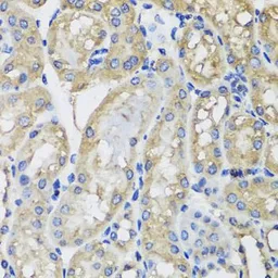 Anti-MRPS22 antibody used in IHC (Paraffin sections) (IHC-P). GTX65972