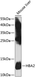 Anti-Hemoglobin alpha 2 antibody used in Western Blot (WB). GTX65974