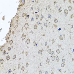 Anti-Hemoglobin alpha 2 antibody used in IHC (Paraffin sections) (IHC-P). GTX65974