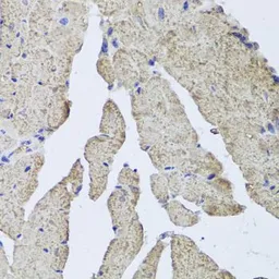 Anti-Hemoglobin alpha 2 antibody used in IHC (Paraffin sections) (IHC-P). GTX65974