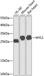 Anti-Fast skeletal myosin light chain 1 antibody used in Western Blot (WB). GTX65975