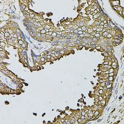 Anti-Fast skeletal myosin light chain 1 antibody used in IHC (Paraffin sections) (IHC-P). GTX65975