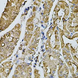 Anti-Fast skeletal myosin light chain 1 antibody used in IHC (Paraffin sections) (IHC-P). GTX65975