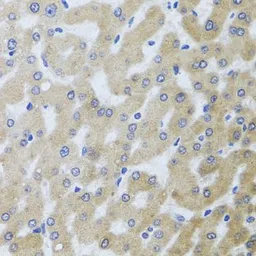 Anti-UVRAG antibody used in IHC (Paraffin sections) (IHC-P). GTX65976