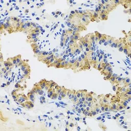 Anti-UVRAG antibody used in IHC (Paraffin sections) (IHC-P). GTX65976
