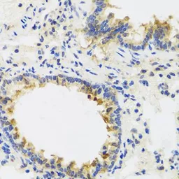 Anti-UVRAG antibody used in IHC (Paraffin sections) (IHC-P). GTX65976