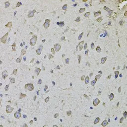 Anti-ARHGEF3 antibody used in IHC (Paraffin sections) (IHC-P). GTX65977
