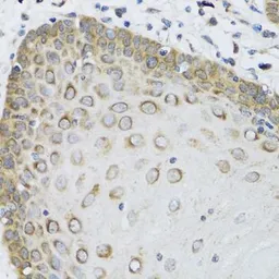 Anti-FAM20A antibody used in IHC (Paraffin sections) (IHC-P). GTX65978