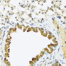 Anti-FAM20A antibody used in IHC (Paraffin sections) (IHC-P). GTX65978