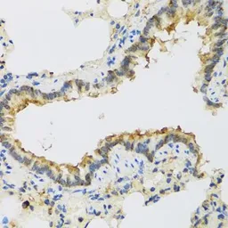 Anti-FAM20A antibody used in IHC (Paraffin sections) (IHC-P). GTX65978