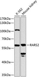 Anti-RARS2 antibody used in Western Blot (WB). GTX65980