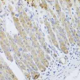 Anti-RARS2 antibody used in IHC (Paraffin sections) (IHC-P). GTX65980