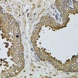 Anti-MTIF3 antibody used in IHC (Paraffin sections) (IHC-P). GTX65982