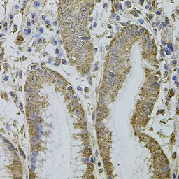 Anti-MTIF3 antibody used in IHC (Paraffin sections) (IHC-P). GTX65982