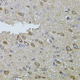 Anti-MTIF3 antibody used in IHC (Paraffin sections) (IHC-P). GTX65982