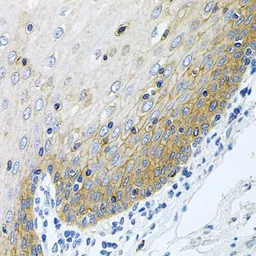 Anti-GLCNE antibody used in IHC (Paraffin sections) (IHC-P). GTX65984