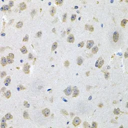 Anti-GLCNE antibody used in IHC (Paraffin sections) (IHC-P). GTX65984