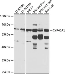 Anti-CYP46A1 antibody used in Western Blot (WB). GTX65985