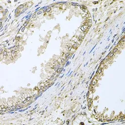 Anti-CYP46A1 antibody used in IHC (Paraffin sections) (IHC-P). GTX65985