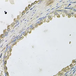 Anti-MTERFD1 antibody used in IHC (Paraffin sections) (IHC-P). GTX65988