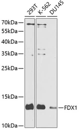Anti-Adrenodoxin antibody used in Western Blot (WB). GTX65989