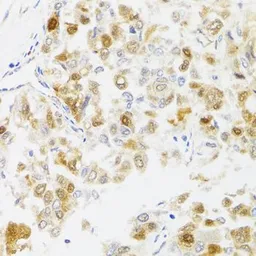 Anti-MYO5A antibody used in IHC (Paraffin sections) (IHC-P). GTX65990