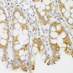 Anti-MYO5A antibody used in IHC (Paraffin sections) (IHC-P). GTX65990