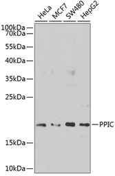 Anti-Cyclophilin C antibody used in Western Blot (WB). GTX65991