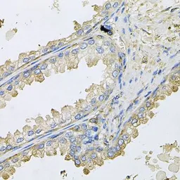 Anti-Cyclophilin C antibody used in IHC (Paraffin sections) (IHC-P). GTX65991