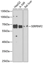 Anti-Alpha 2 Antiplasmin antibody used in Western Blot (WB). GTX65993